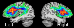 Stuttering rain research